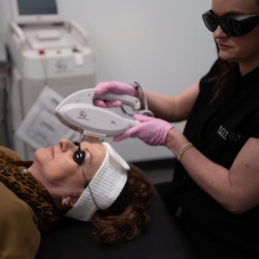 Laser Away My Brown Spots – What You Need To Know!