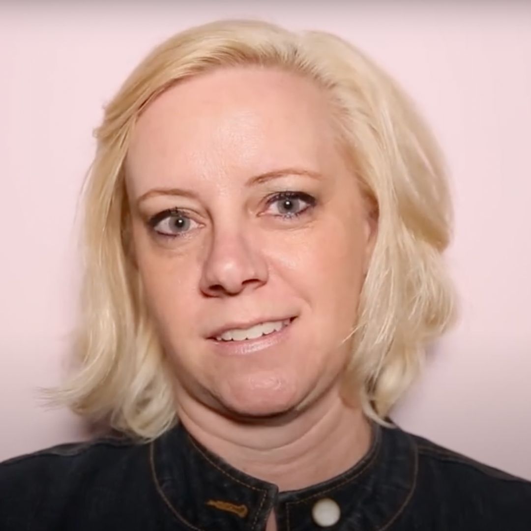 Better with Age:  Brooke’s Kybella Treatment