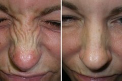 1651090291-8a402aac-e911-4cd3-bcdb-19f21563bd65