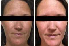 1699556541-glow-up-10