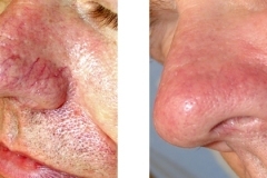 1651091056-b745817d-185f-4a12-86ab-d23f8a3437ca