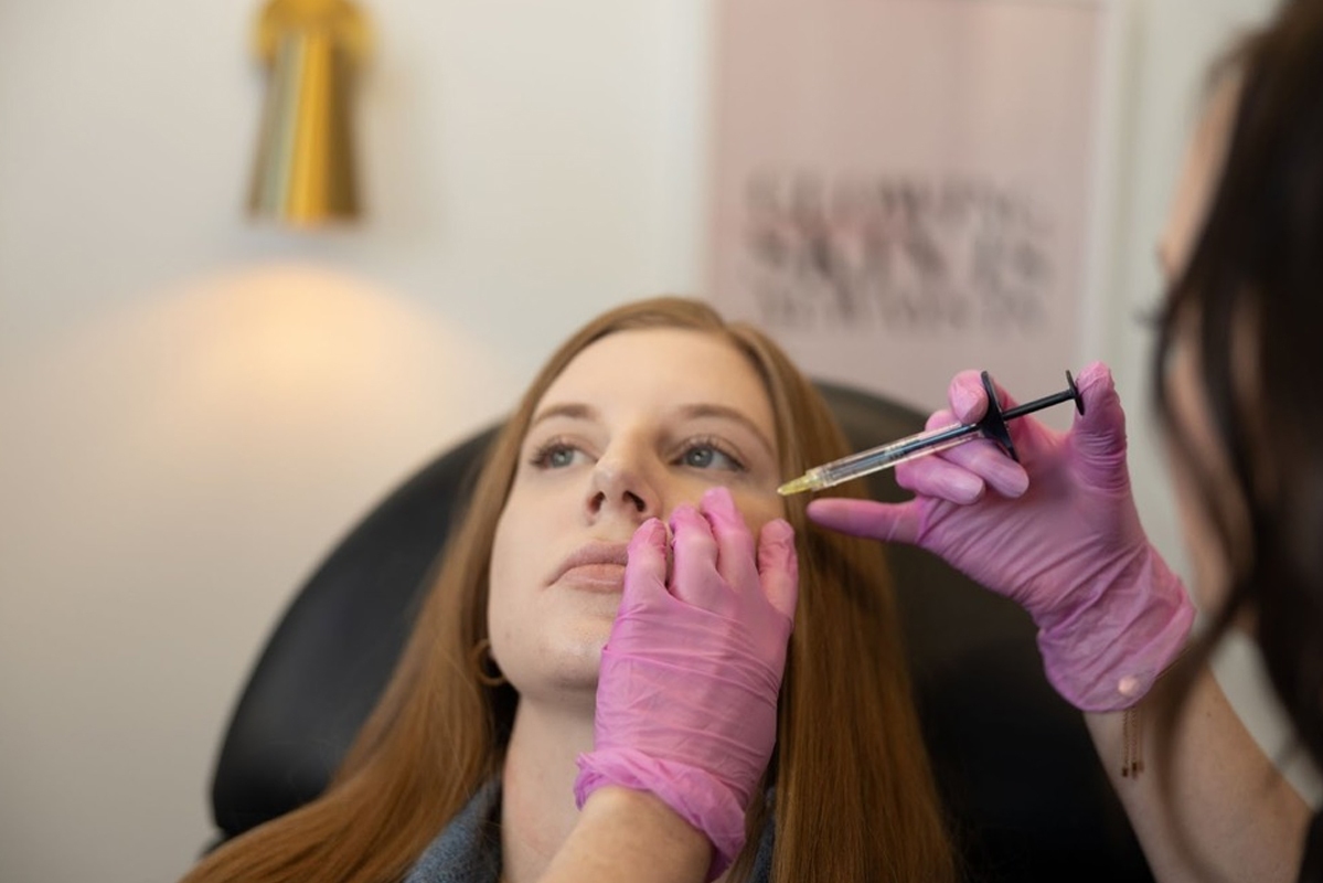 Cheek and Lip Fillers – How to Enhance Your Features Without Looking Overdone