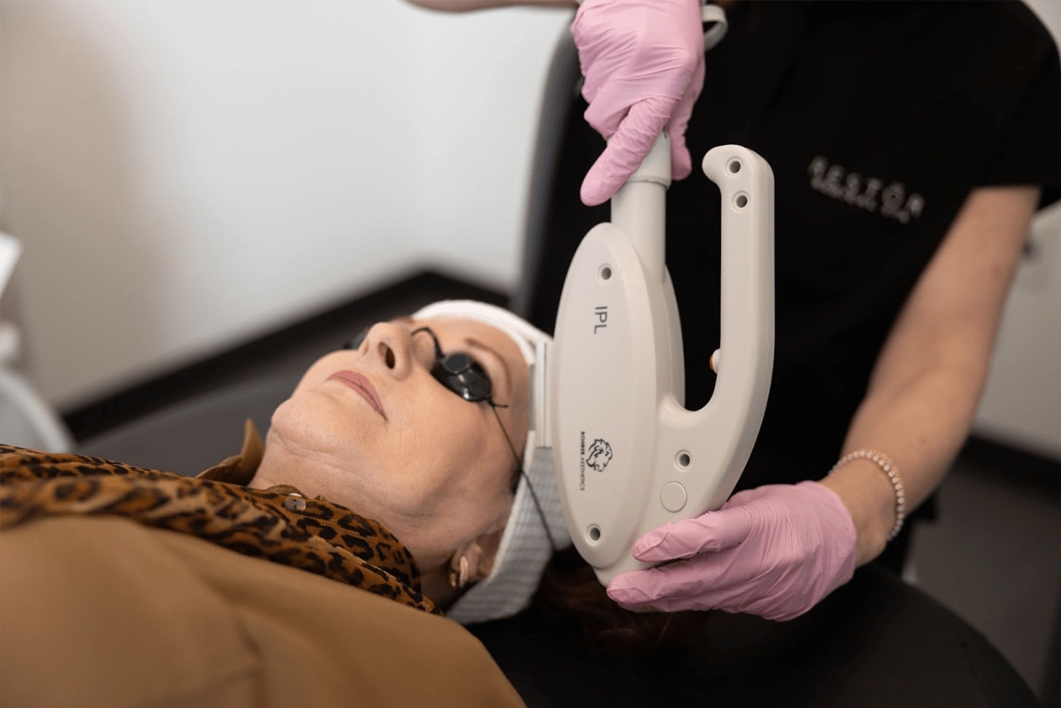 Laser Away My Brown Spots –  What You Need To Know!